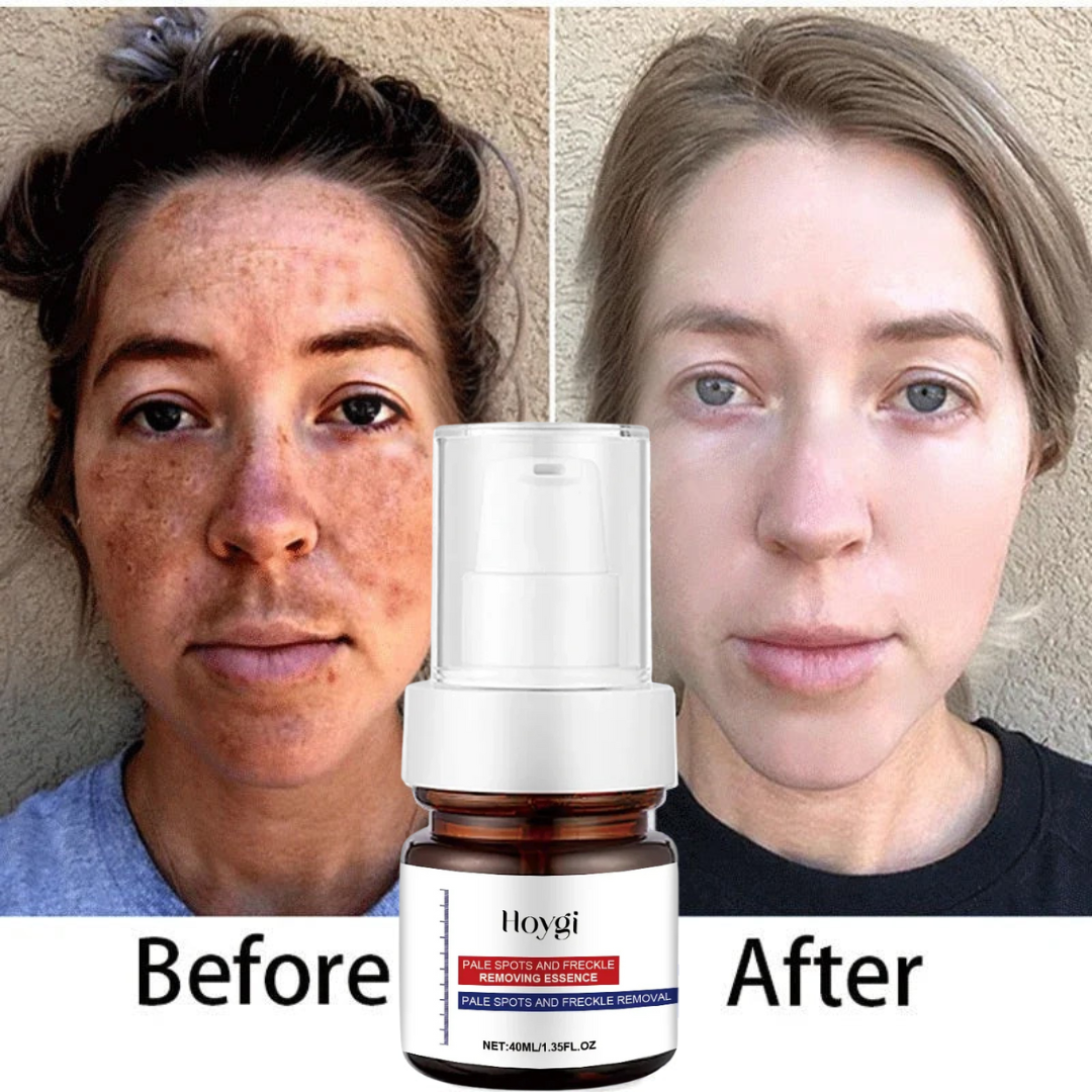 Clarigen Hoygi Vitamin C Dark Spot Corrector Cream – Brightening & Skin Tone Evening Moisturizer