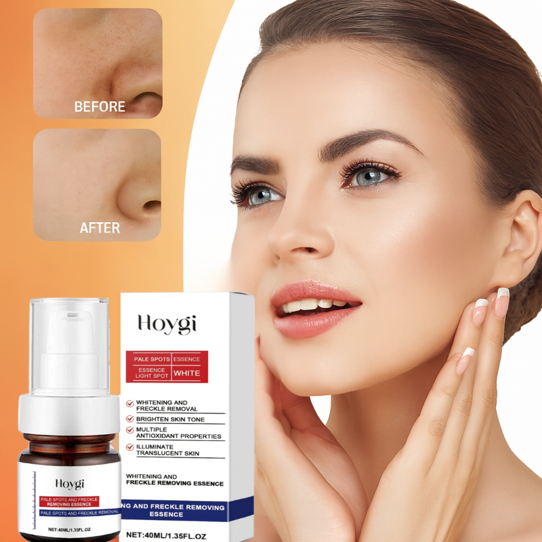 Clarigen Hoygi Vitamin C Dark Spot Corrector Cream – Brightening & Skin Tone Evening Moisturizer