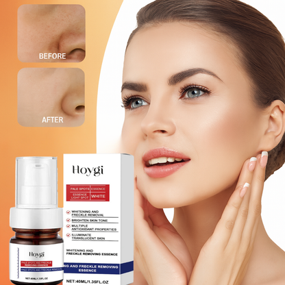 Clarigen Hoygi Vitamin C Dark Spot Corrector Cream – Brightening & Skin Tone Evening Moisturizer