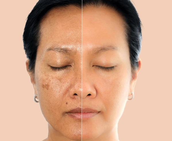 Embrace Confidence With Your Radiant New Skin